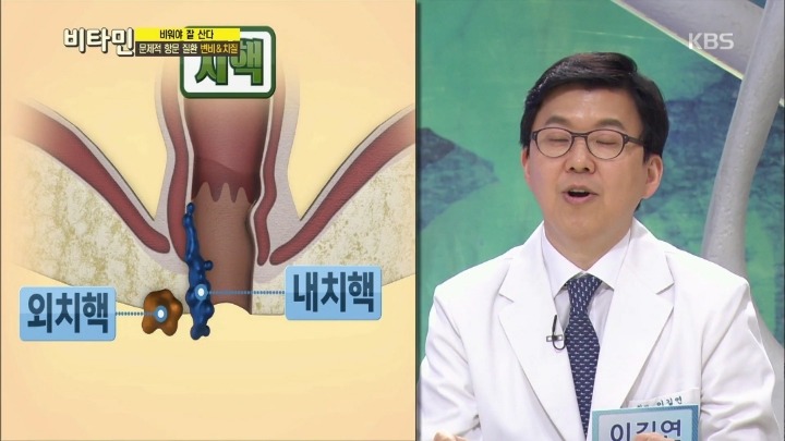 항문이 간지럽다면? | 인스티즈
