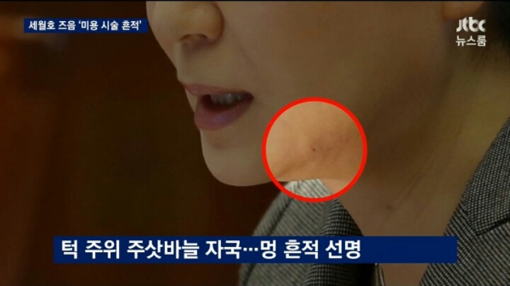 오늘자 JTBC 세월호 참사직후 피부시술 흔적 | 인스티즈