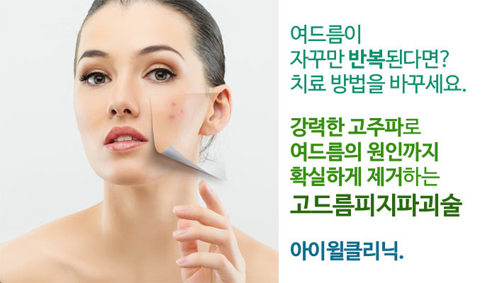 아이윌 이미지