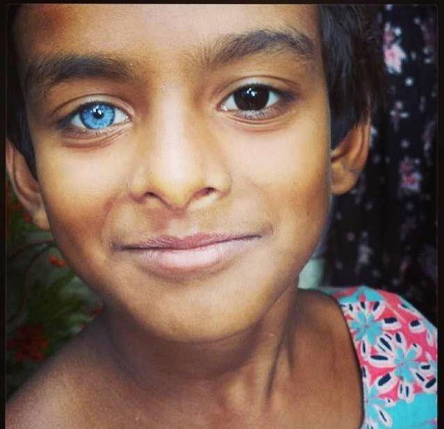 사람들이 하는 오해: 아시아 사람들은 다 눈동자가 짙은갈색? | 인스티즈