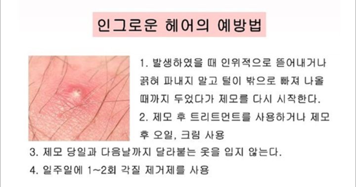 제모하는 여시들 짜증나는거 甲.jpg | 인스티즈