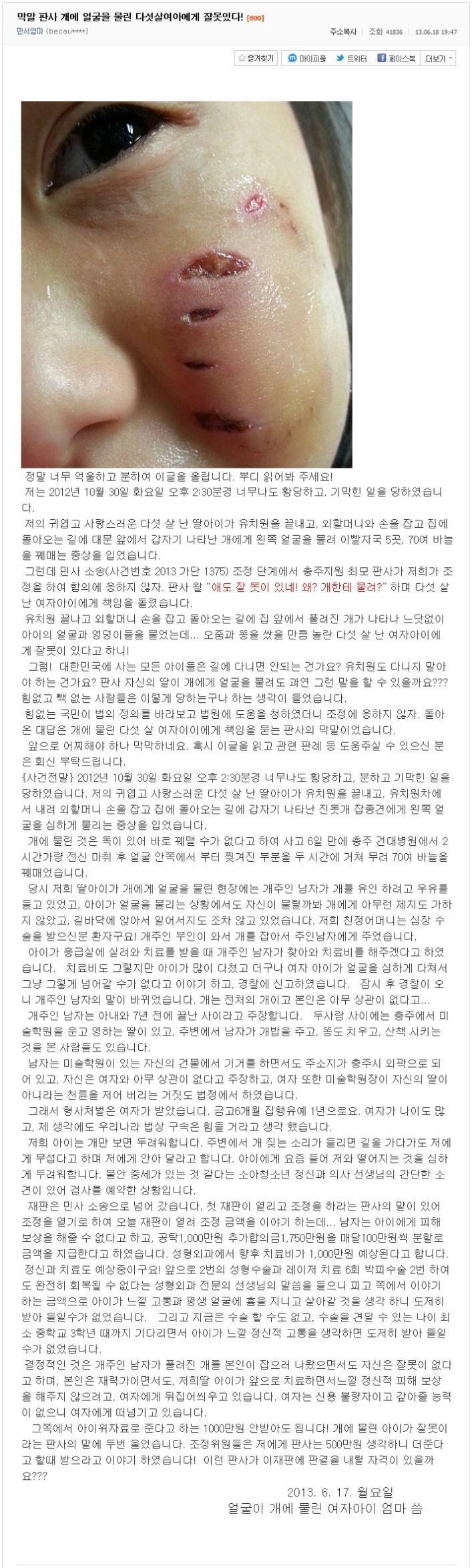 막말 판사!! 개에게 물린 5살 꼬마에게 잘못이 있다 (사진 약 놀람주의) | 인스티즈