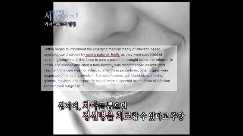 [서프라이즈] 잘못된 수술 레이크우드의 망령.jpg | 인스티즈