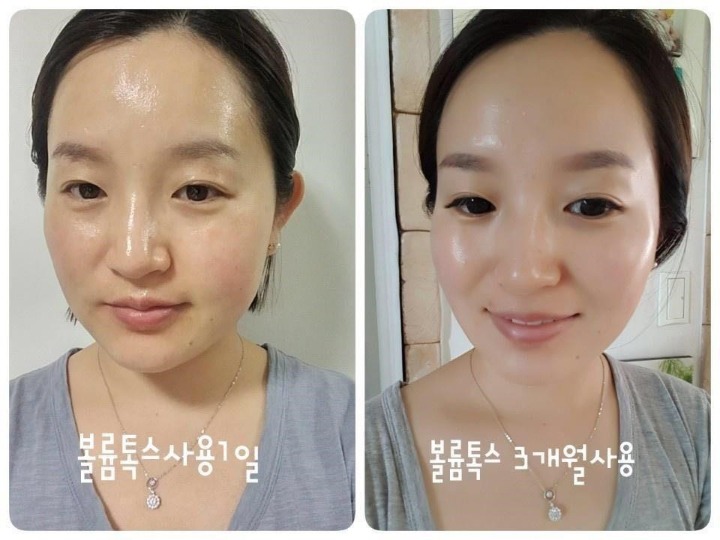 집톡스 이미지