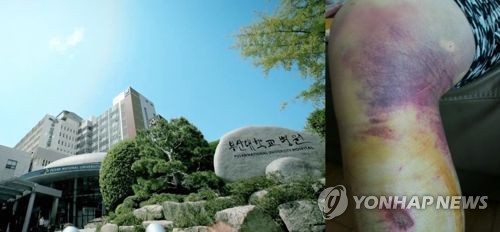 폭행피해 부산대병원 전공의 10명 "가해교수 선처바란다" | 인스티즈